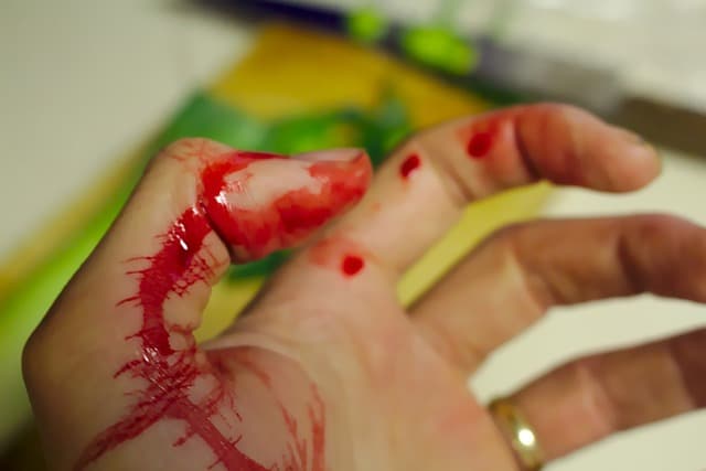 Herida en la mano